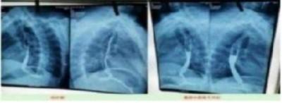 国医楷模陈海林 | 癌细胞逆转正常生理细胞 引起全球广泛关注 —— 五一特别报道